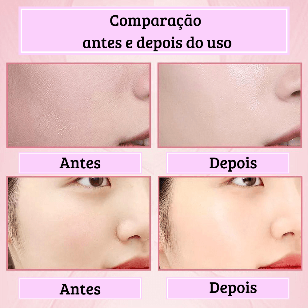 Creme para pele - Hunmui™ [Removedor de Melasma, Clareador]