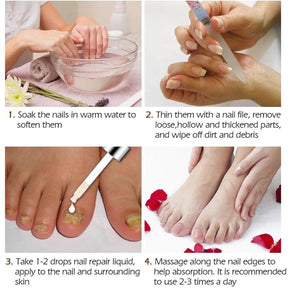 Gel anti-infeccioso Suai prego para fungos na unha